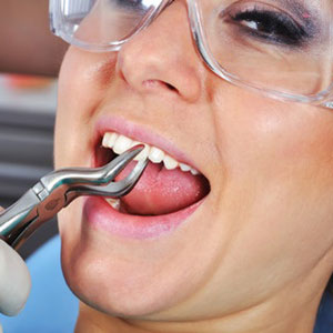 Tooth-Extraction-Garland