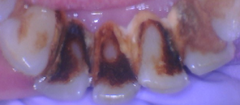 Before