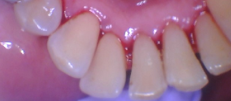 After