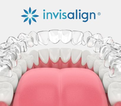 Invisalign vs. Other Clear Aligners: What Makes It Different?