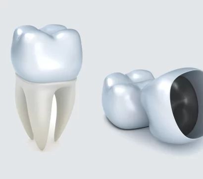 What Happens If You Delay Getting a Dental Crown?